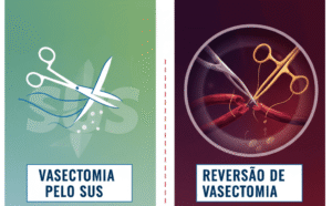 Vasectomia Pelo SUS