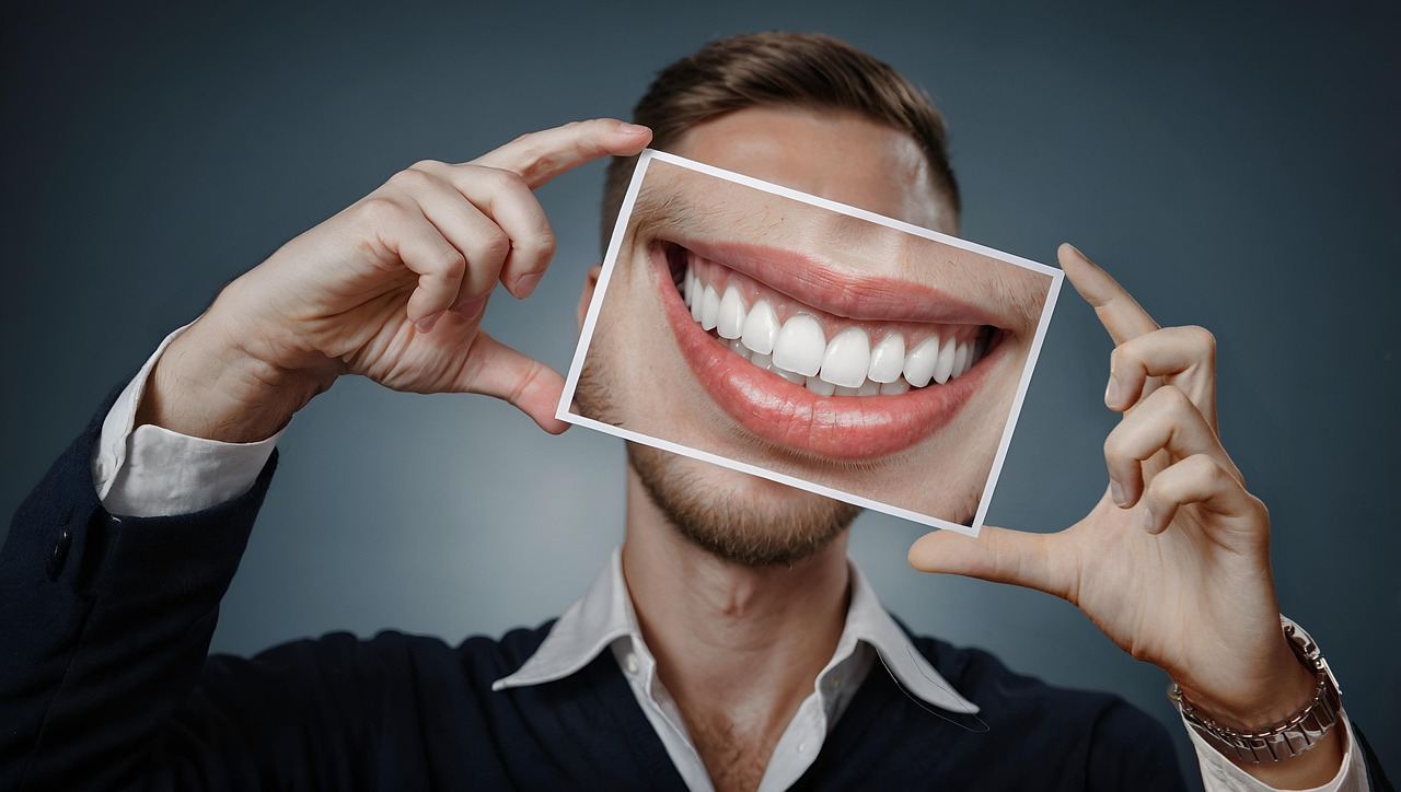 Implante Dentário